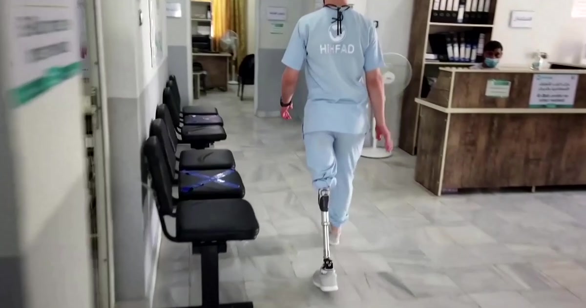 Meet the amputee doctor designing prosthetics Truvid